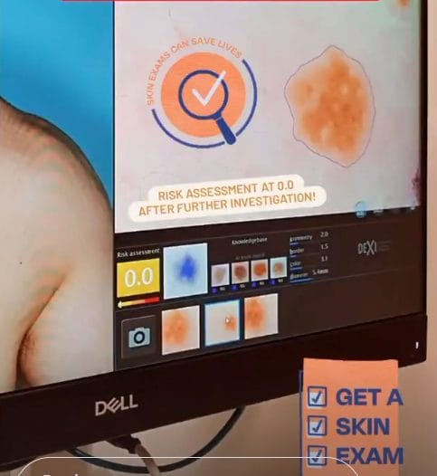 The Dot Work of Dermatology & Surgery Clinic's Mole Mapping Machine